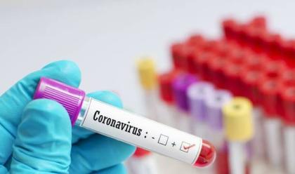 coronavirus-in-e-r-oggi-32-nuovi-casi-romagna-2-92-guarigioni-e-4-decessi